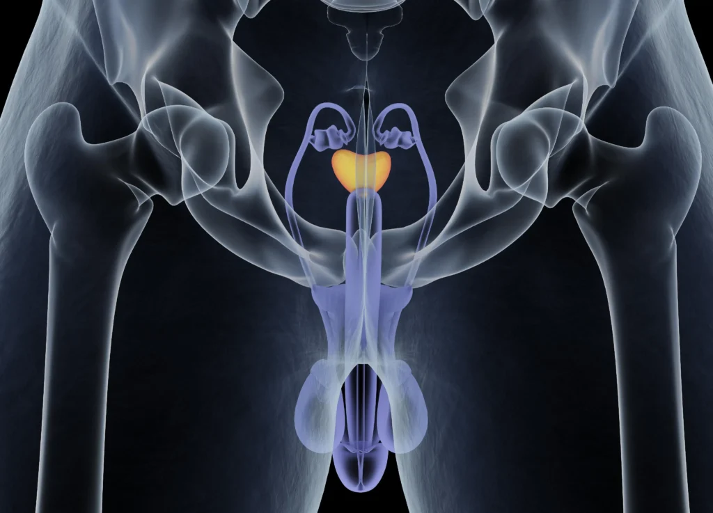 Prostate